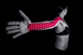 Medical taping for arm pain relief.