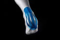 Medical taping for calcaneal pain relief. Royalty Free Stock Photo