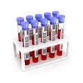 Medical test tubes with blood in holder