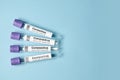 Medical test tubes with a test for coronavirus on blue background. Tests to determine the covid-19 virus. Royalty Free Stock Photo