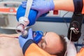 Medical urgency in the ambulance. Cardiopulmonary resuscitation using hand valve mask bag