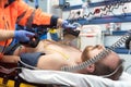 Medical urgency in the ambulance. Emergency doctor using defibrillator Royalty Free Stock Photo