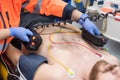 Medical urgency in the ambulance. Emergency doctor using defibrillator