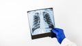 X-ray of a person`s lungs in the hands of a doctor,chest picture,on a white background,a place for a text,close-up. Royalty Free Stock Photo