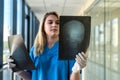 Medical worker looks at xray film of the skull to detect signs of the disease Royalty Free Stock Photo