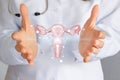A medical worker shows the uterus in hands Royalty Free Stock Photo