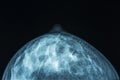 Medical xray scan of a female breast