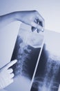 Medical xray spine neck scan Royalty Free Stock Photo