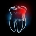 Medically Accurate Aching Tooth X-Ray View with Red Zone of Pain. 3d Rendering