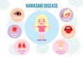 Medicals poster of the Kawasaki disease in vector design