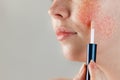 Medicine and cosmetology. Female cheek with rosacea close-up, with cosmetic Foundation on a brush near the skin. Copy space