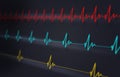 Fast Normal Slow Heartbeat ecg Royalty Free Stock Photo