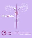 Medicine info-graphic about myoma, menstrual cycle,