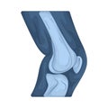 bone joint Royalty Free Stock Photo