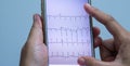 Medical concept, doctor looking ECG of the patient in smartphone that showing tachycardia rhythm of heart disease.