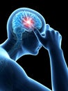 Megrim/headache Royalty Free Stock Photo