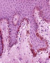 Melanocytes. Epidermis Royalty Free Stock Photo