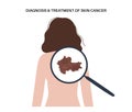 Skin cancer diagnosis