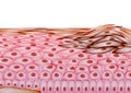 Melanoma in Layers of the Human skin, Cancer - Vector Illustration