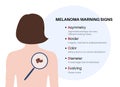 Melanoma warning signs