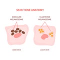 Melanosome distribution pattern in dark and light skin