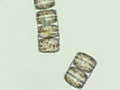 Melosira sp. algae under microscopic view Royalty Free Stock Photo