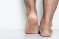 Men a feet skin cracked heels
