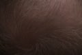 Men hair loss problem alopecia