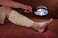 Men`s leg in a bandage and ankle heat a blue lamp