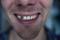 Men's smile without tooth. fragment of face