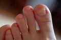 Men`s toes, healthy toe nails