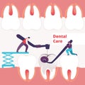 Men Treating Giant Unhealthy Tooth with Caries