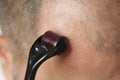 Men using microneedle derma roller on head for stimulating new hair growth.