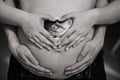 men& x27;s hands hold pregnant woman& x27;s abdomen, and female hold photo ultrasound Royalty Free Stock Photo