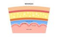 Meninges anatomy diagram