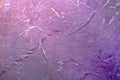 Meningioma, light micrograph, photo under microscope