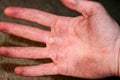 Mens dirty hand. Corns on their hands Royalty Free Stock Photo