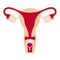 Menstrual cup in use, female period hygiene product in uterus. Vector illustration isolated on white.