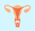 Menstrual cup