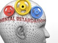 Mental retardation and human mind - pictured as word Mental retardation inside a head to symbolize relation between Mental Royalty Free Stock Photo