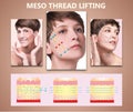 Meso thread Lift. Young female with clean fresh skin. Beautiful woman. face and neck.