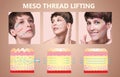 Meso thread Lift. Young female with clean fresh skin. Beautiful woman. face and neck.