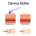 Mesorolling process and cell structure, before after effect Royalty Free Stock Photo