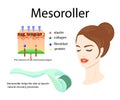 Mesoroller application, face of a girl and skin structure