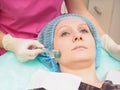 Mesoteraphy microneedle procedure. Rejuvenation, revitalization, skin nutrition, wrinkle reduction.