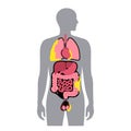 Mesothelioma tumor types