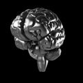 Metal brain