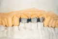 Metal cast pin of a human tooth on a gypsum model close-up in a dental laboratory. Orthopedic dentistry preparation for crown Royalty Free Stock Photo