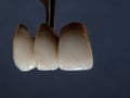 Ceramik tooth