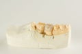 Metal ceramic dental crown photographed close-up Royalty Free Stock Photo